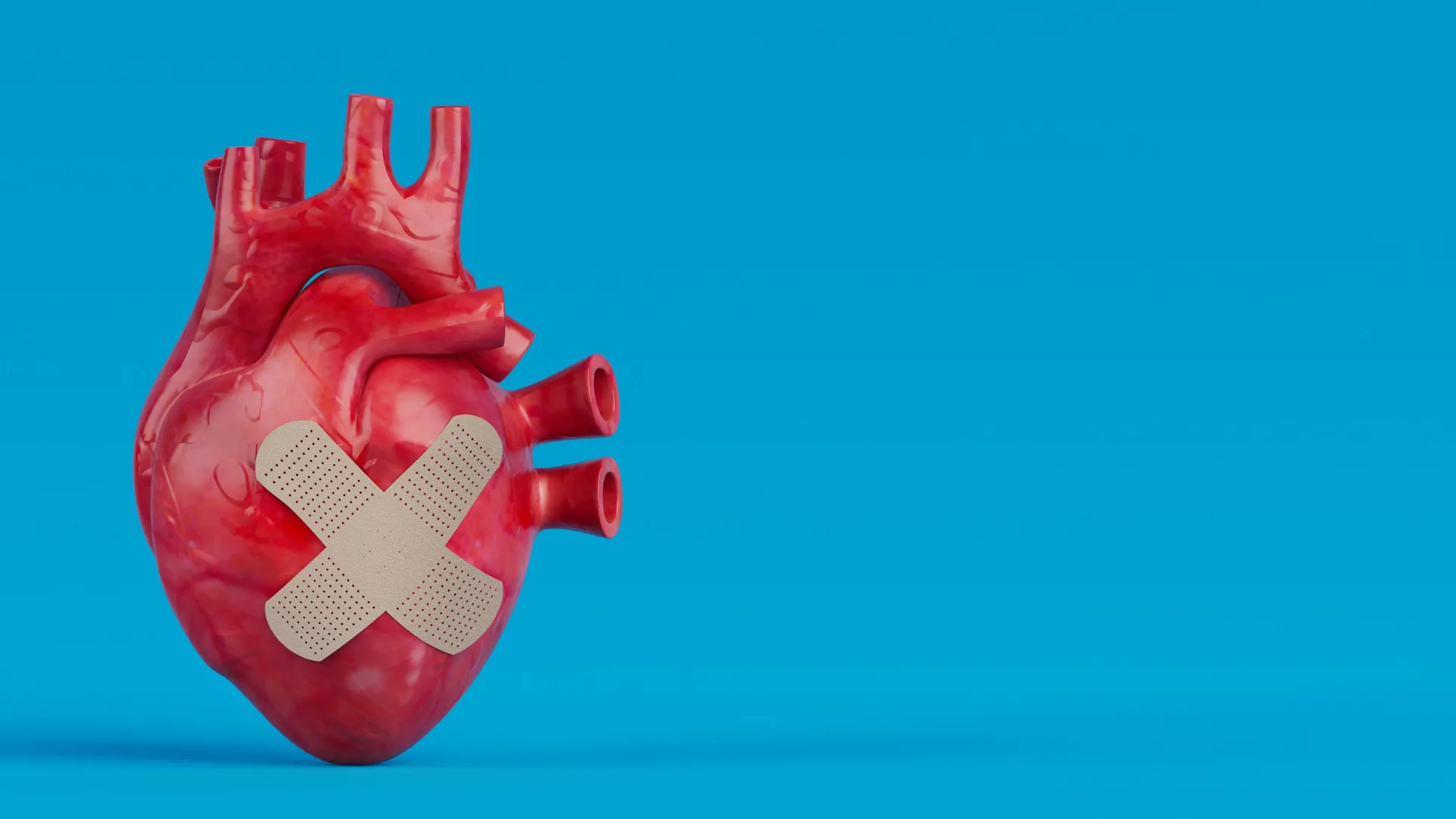 Personalized Vitamin D Management May Halve Second Heart Attack Risk