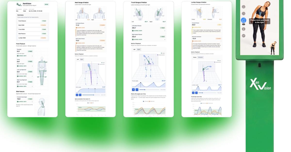 AI Platform Screens for Musculoskeletal Issues in Under Two Minutes