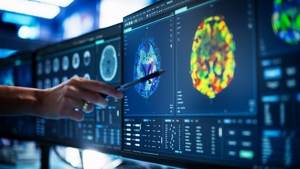 AI Tool Spots Pancreatic Cancer Signs 16 Months Before Doctors