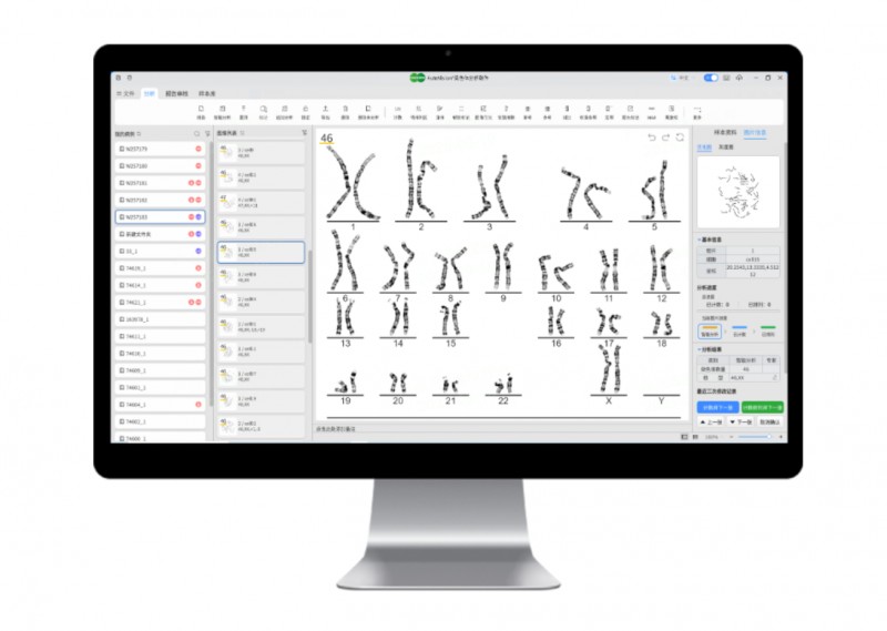 China Approves First AI Tool for Automated Chromosome Analysis