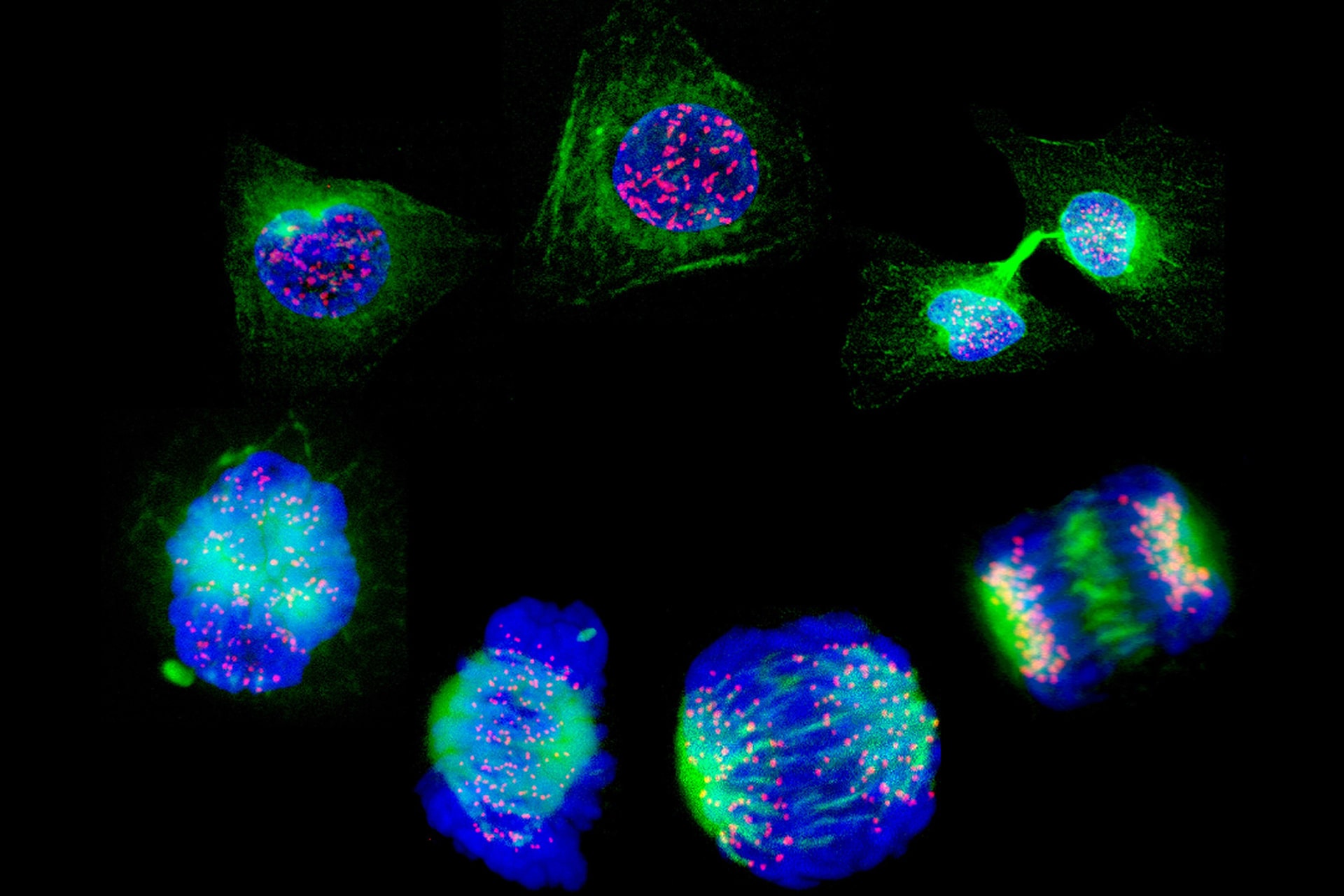 CRISPR Therapy for Rare Swelling Disorder Shows Promise in Key Trial