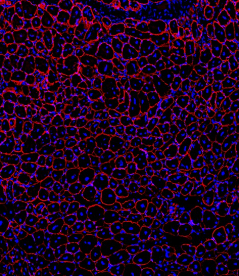 Existing Drug Shows Promise for Preserving Muscle During GLP-1 Weight Loss