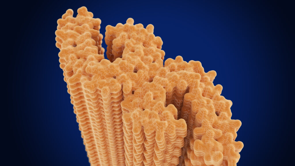 Experimental Biogen Drug Slows Alzheimer’s Decline in Mid-Stage Trial