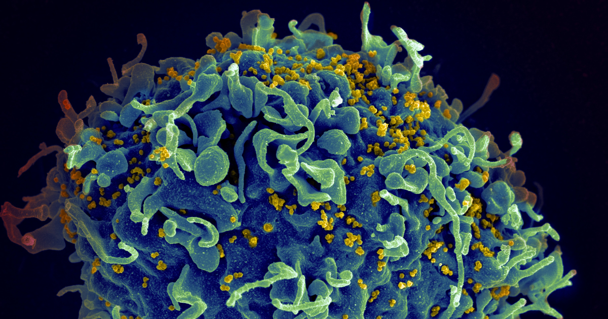 Experimental Drug Shows Promise in Flushing Out Hidden HIV Reservoirs