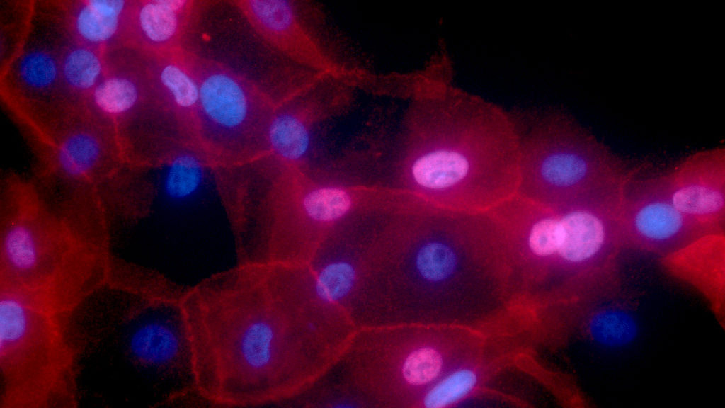 FDA Approves First Celcuity Drug for Advanced Breast Cancer