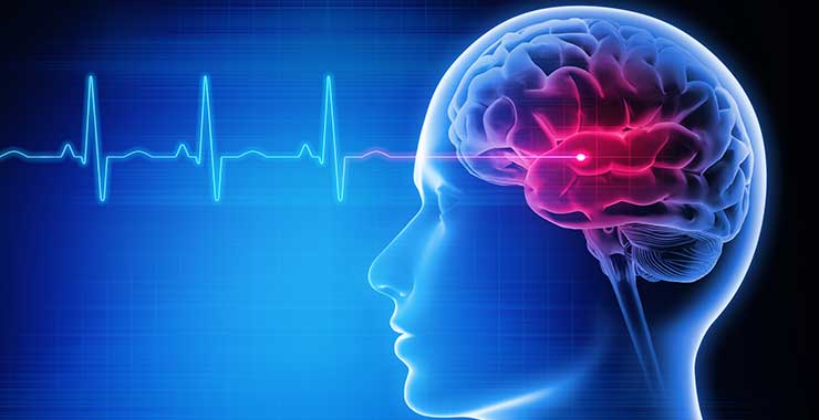 FDA Approves Two Brain Stimulation Devices to Treat PTSD