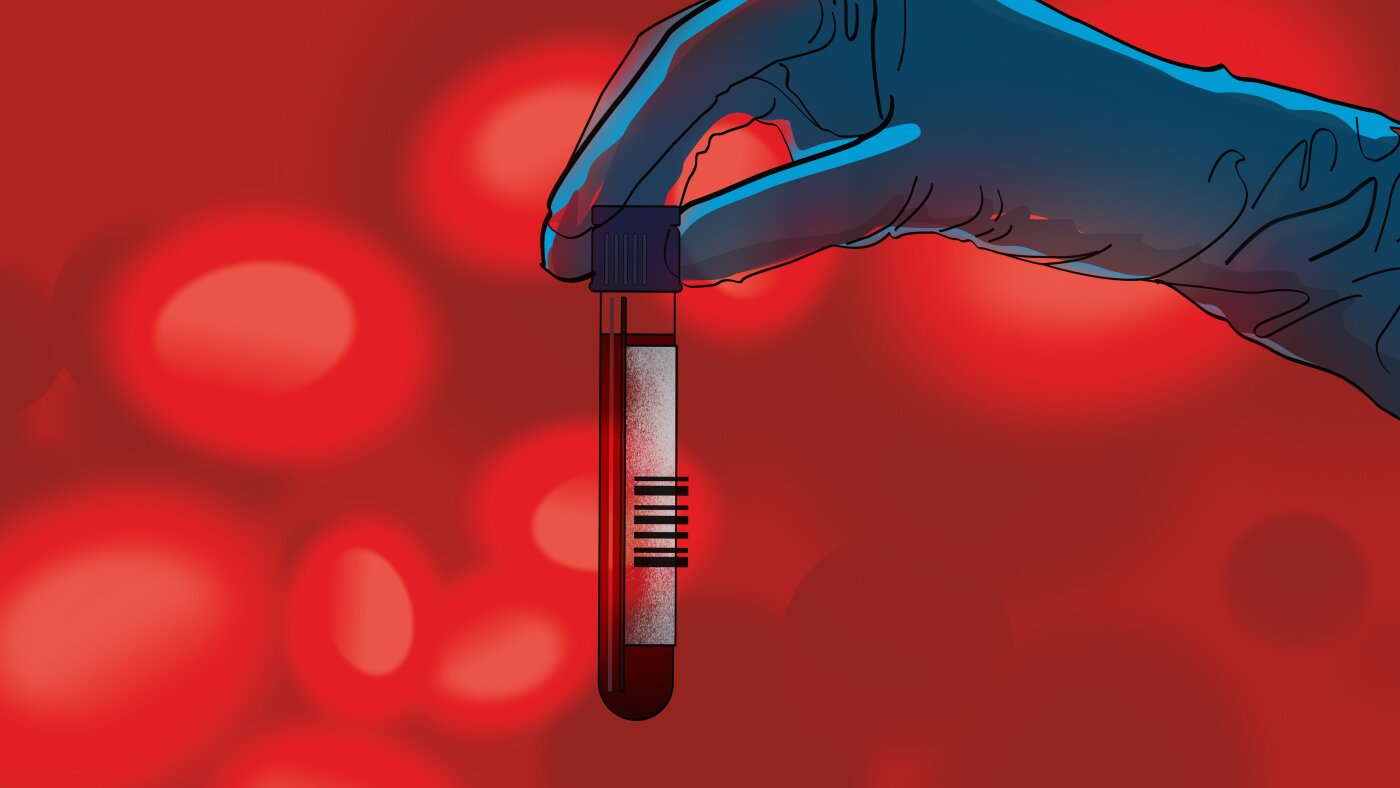 FDA Decision Nears on Blood Test That Detects 50 Types of Cancer
