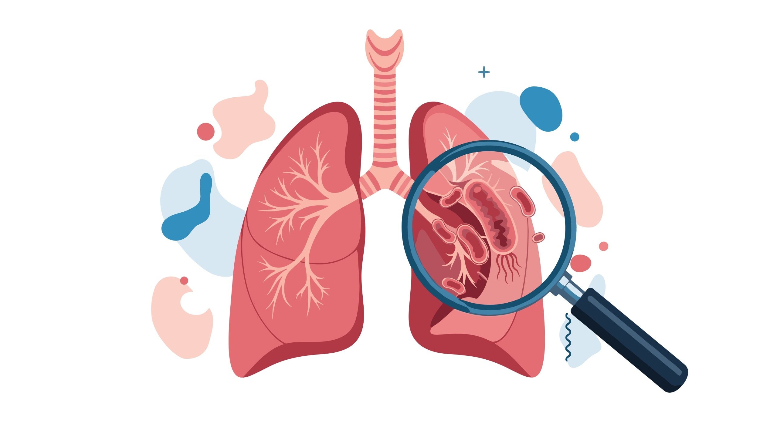 Inhaled Antibiotic Shows Promise for Earlier Treatment of Serious Lung Infection