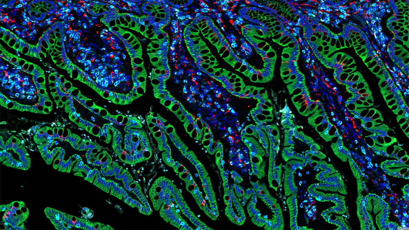 mRNA Vaccines Linked to Doubled Survival in Cancer Immunotherapy Patients