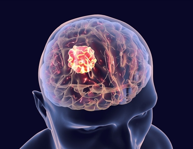 Nanofiber Mesh Delivers Triple Drug Combo to Shrink Brain Tumors