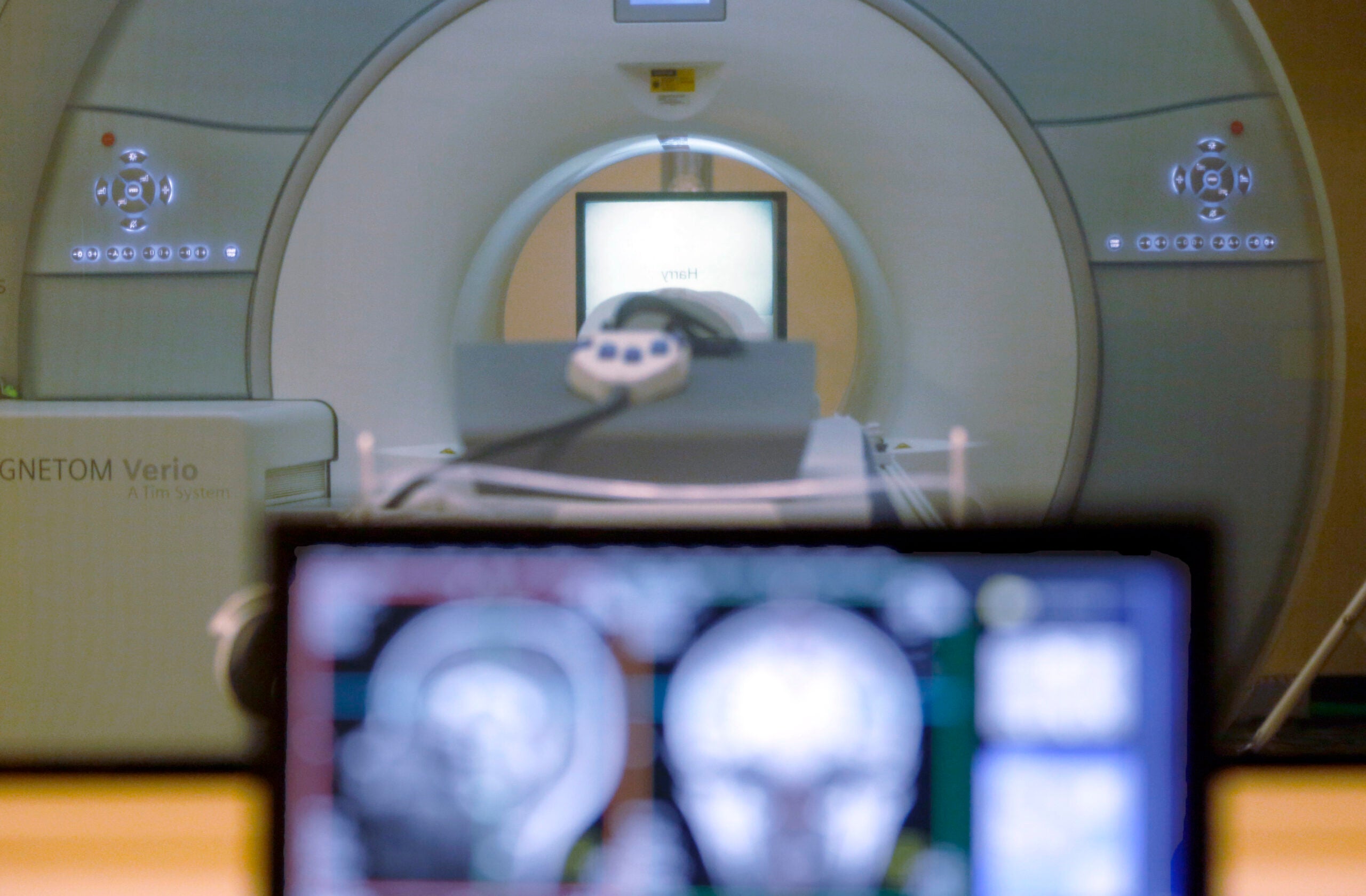 New Epilepsy Treatments Bring Hope for Seizure-Free Lives