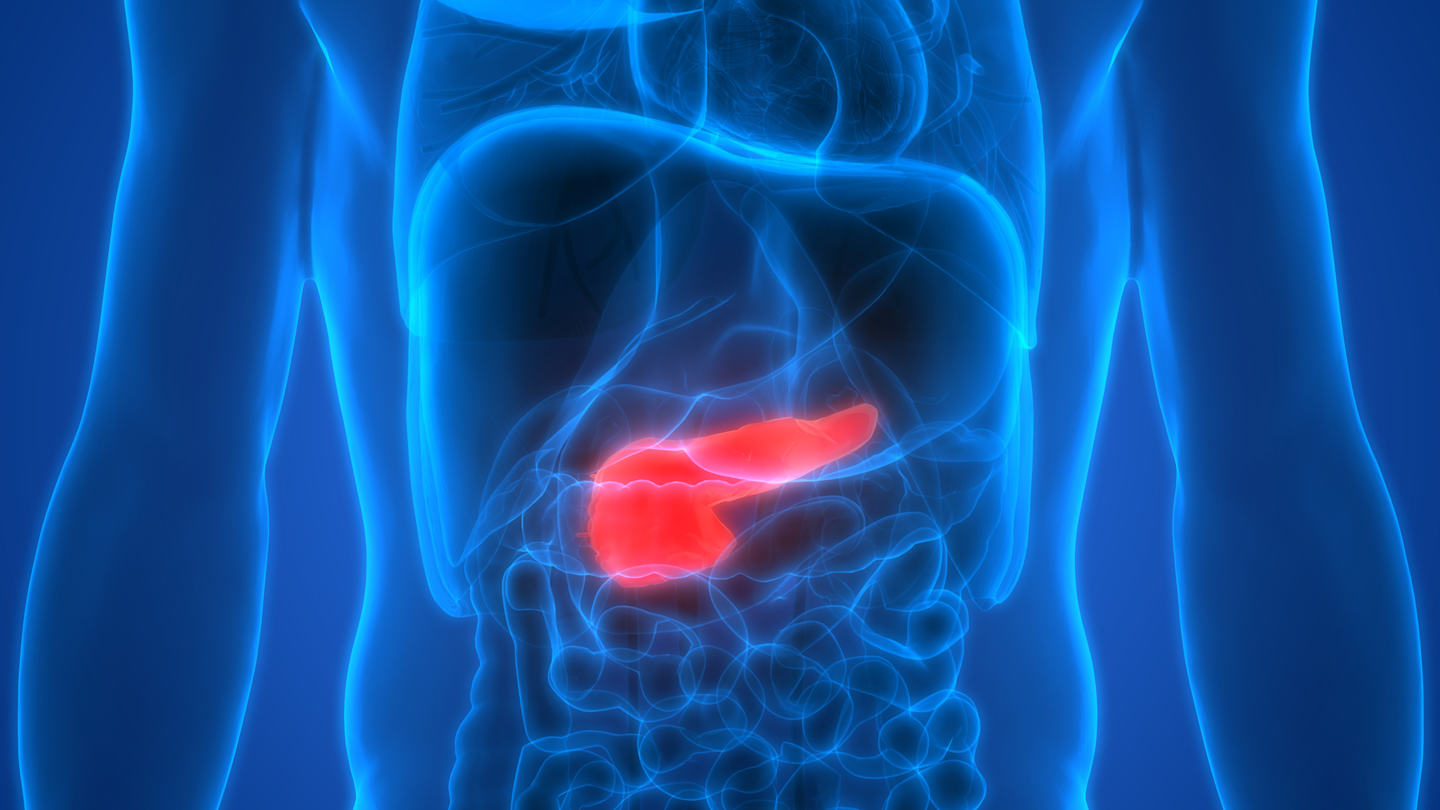 New Pancreatic Cancer Drug Doubles Survival in Advanced Trial
