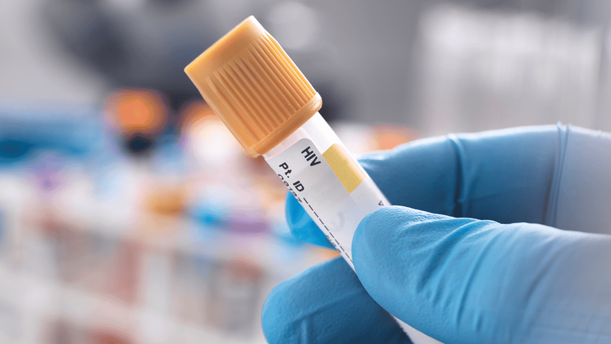 Oslo Patient Becomes Tenth Person Reported Cured of HIV After Stem Cell Transplant