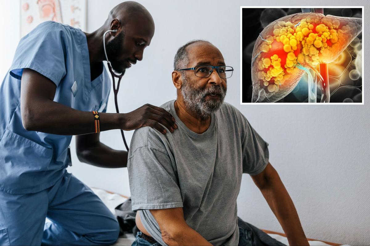 Researchers Reverse Fatty Liver Disease in Mice by Targeting Inflammatory Immune Cells