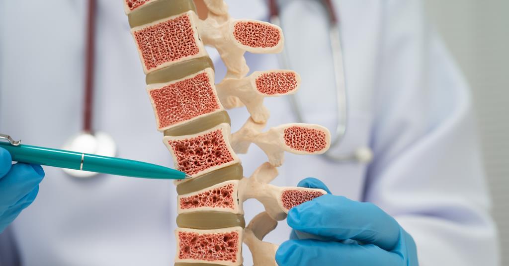 Scientists Discover Molecular Switch That Could Treat Bone Disease
