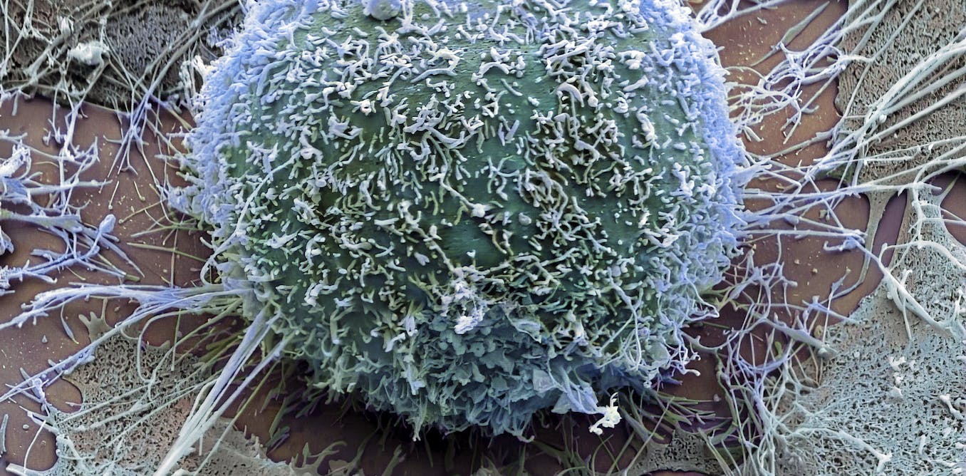Scientists Map How Cancer Disguises Itself to Evade Immune Detection