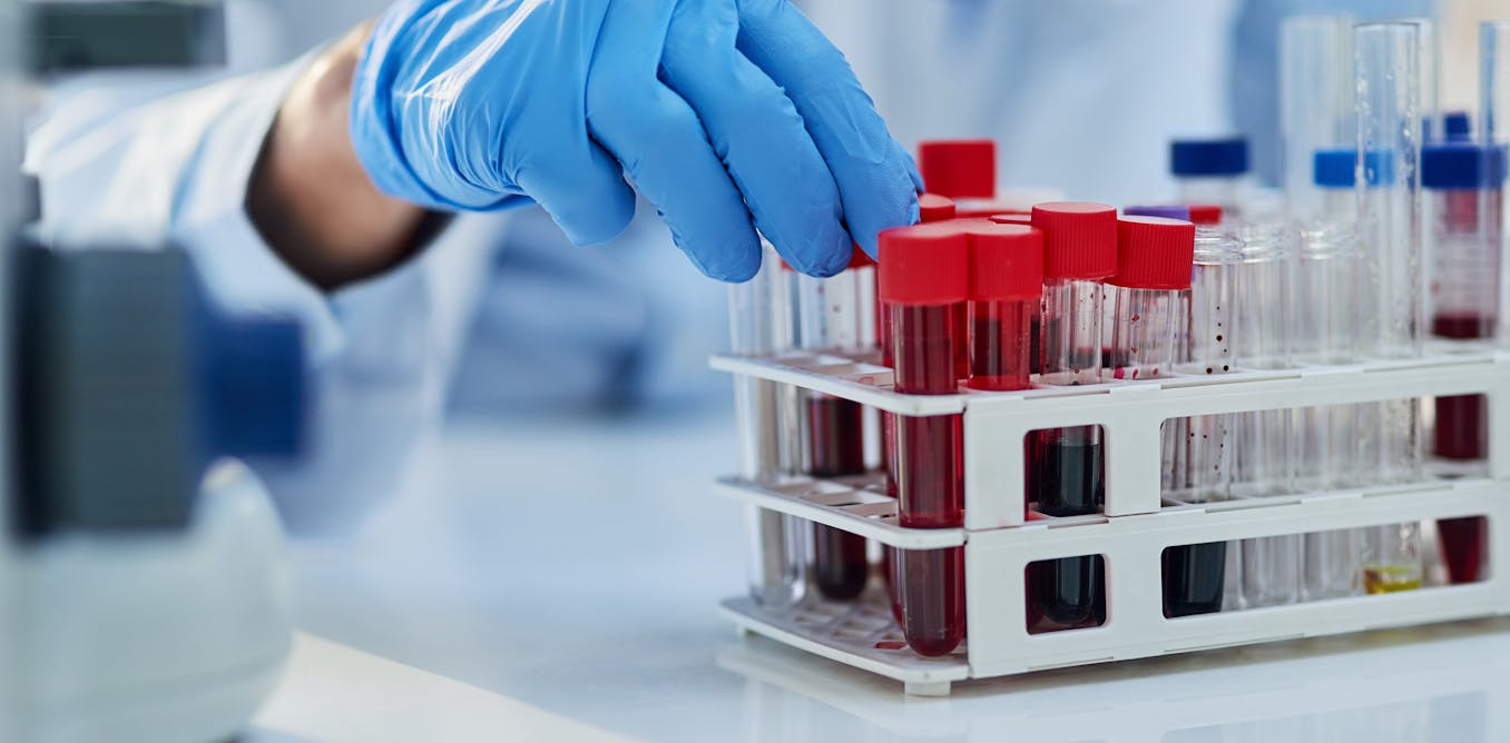 Scientists Pursue Cancer Interception to Stop Disease Before Tumors Form