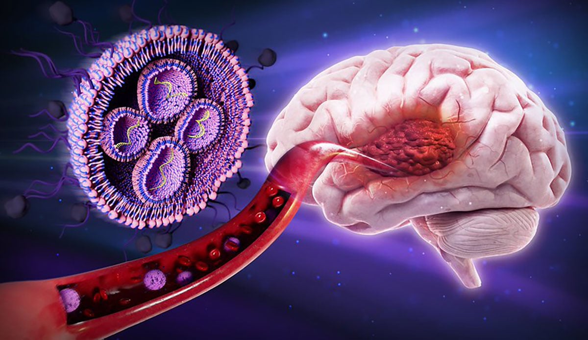 Sugar-Coated Nanoparticles Cross Brain Barrier to Fight Glioblastoma