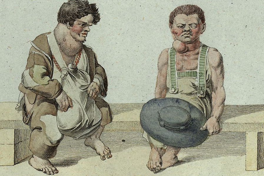 Swiss Doctors Discover Iodized Salt Cure for Historic Alpine Health Scourge